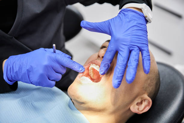 Best Emergency Wisdom Tooth Extraction in Somerset, PA